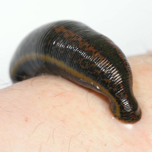 Leech Therepy